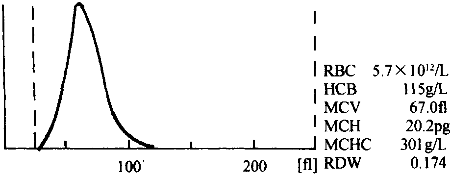 七、红细胞异常直方图